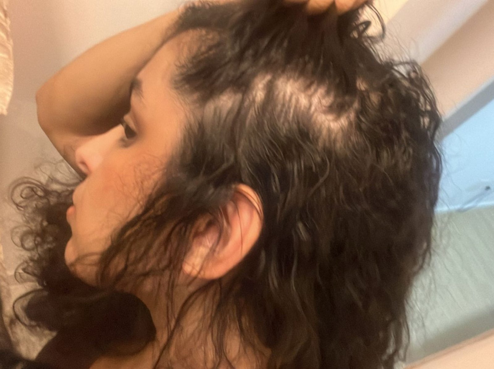 Antes do Tratamento 2