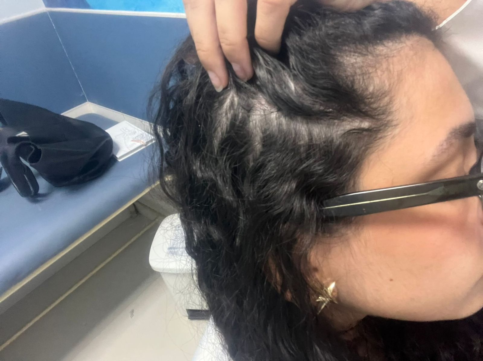 Resultado Depois do Tratamento 2