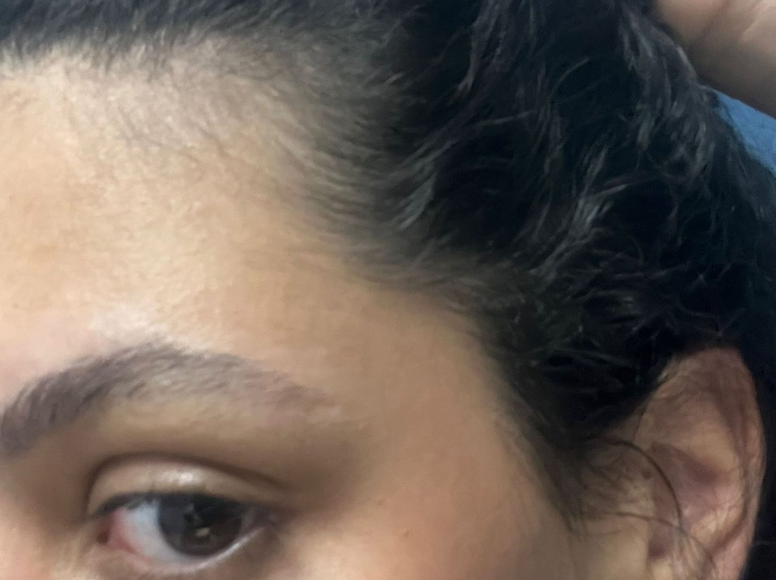 Resultado Depois do Tratamento 1